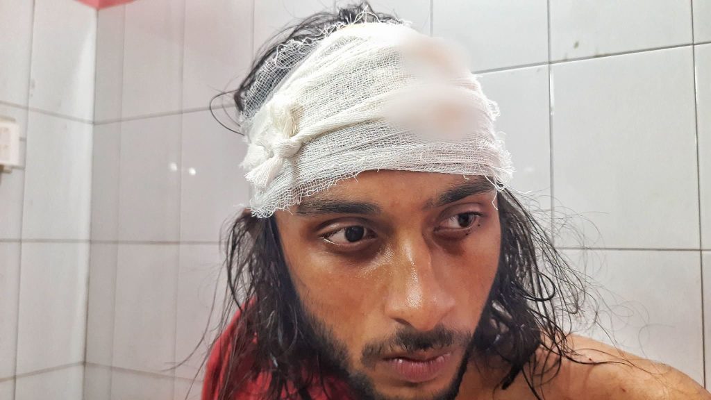 কবি নজরুল বিশ্ববিদ্যালয়ে ছাত্রদলের সং-ঘ-র্ষ : প্রক্টরকে অবজ্ঞা ও শিক্ষার্থীকে হাতু-ড়িপে-টা