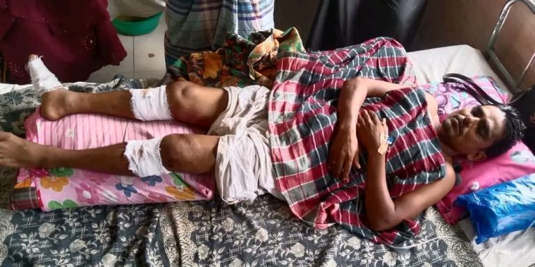 শ্রীপুরে দুর্বৃত্তদের হামলায় স্বেচ্ছাসেবক দলের এক কর্মী গুরুতর আহত
